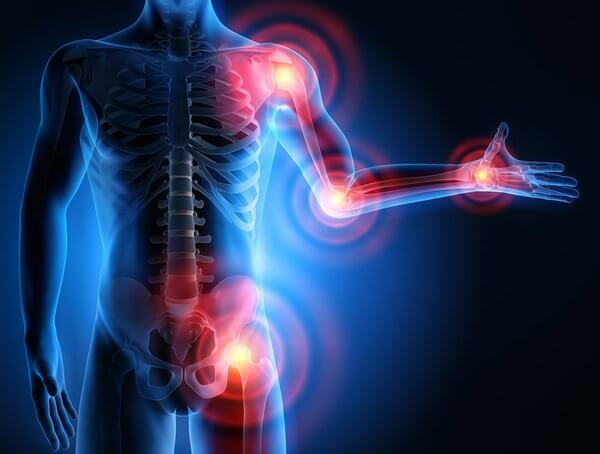 Grafik - Arthrose Bereiche Vitamin E und Arthrose