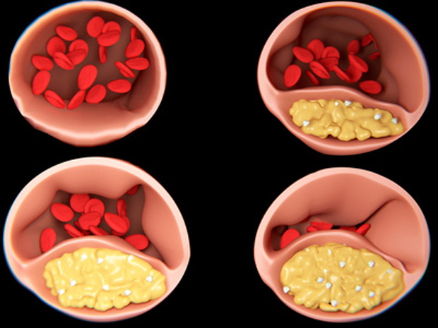 Mit Biotin Cholesterin senken